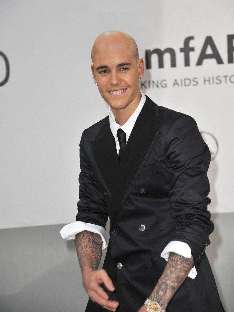 Justin-Beiber-hair-loss-bald