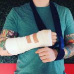 Eda Sheerana udario auto, slomio ruku!